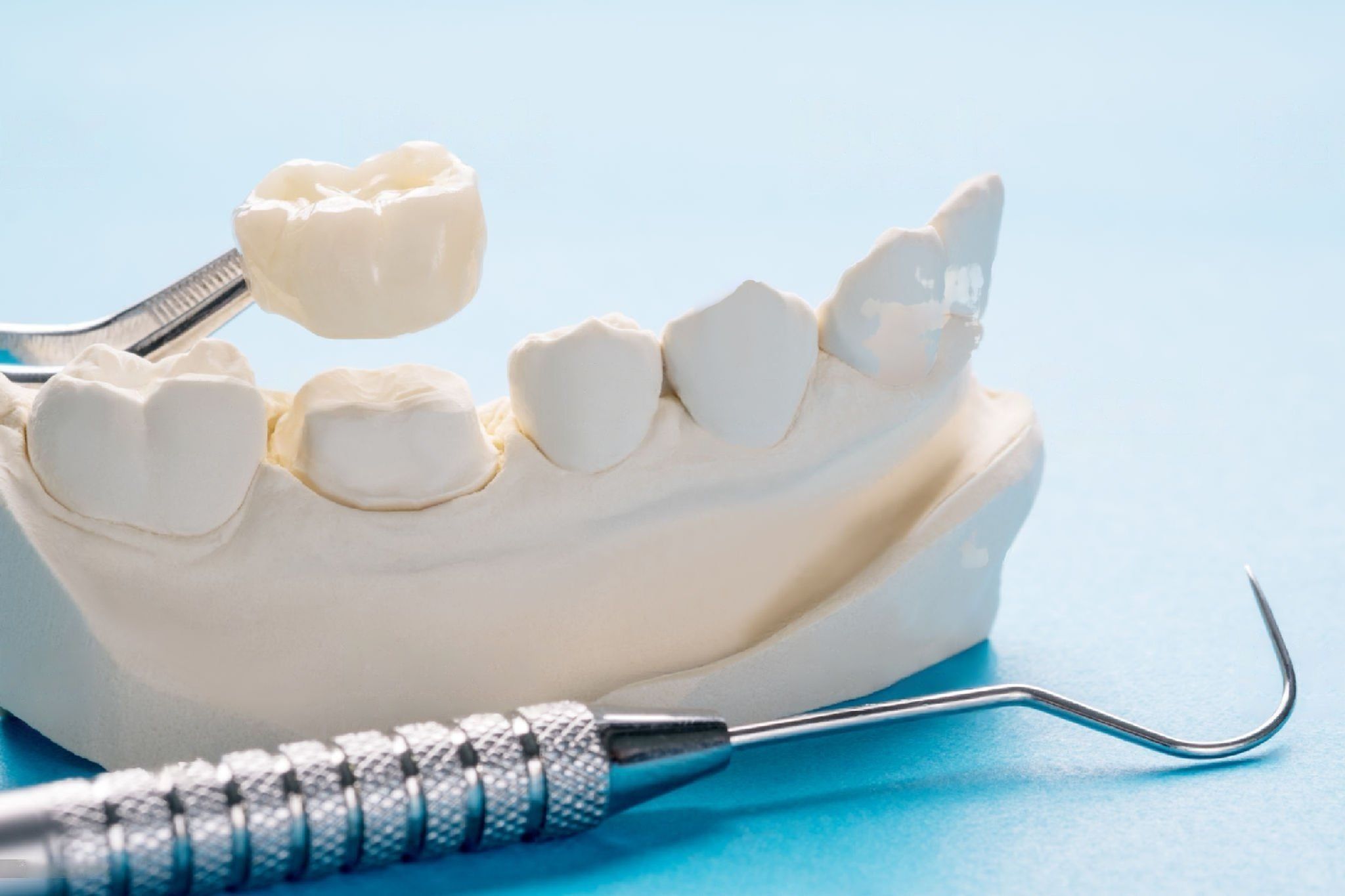 FAQs about CEREC Crowns