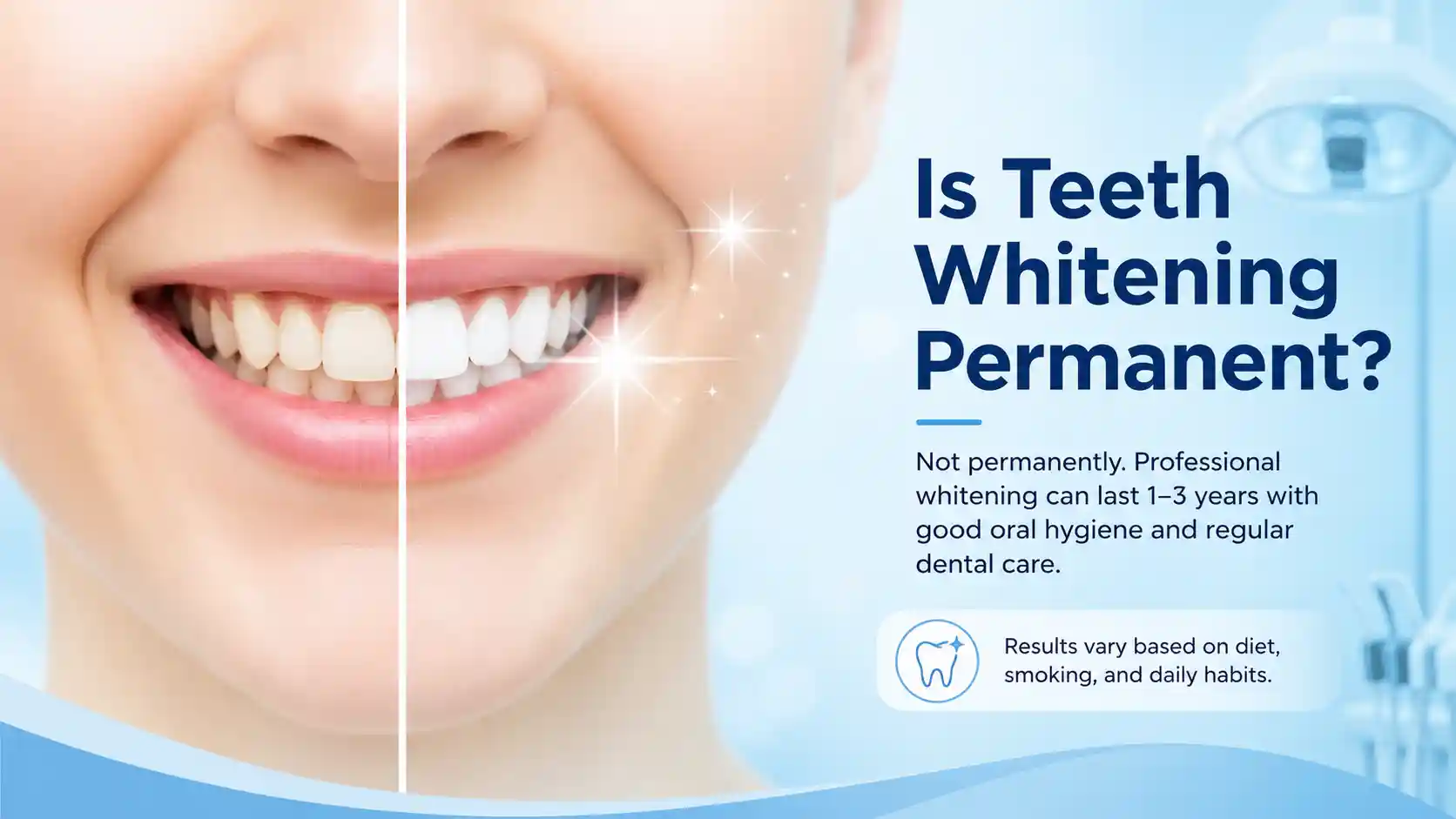 Professional-teeth-whitening-can-provide-noticeable-results-that-last-from-several-months-to-a-few-years-depending-on-the-treatment-your-oral-hygiene-and-your-daily-habits