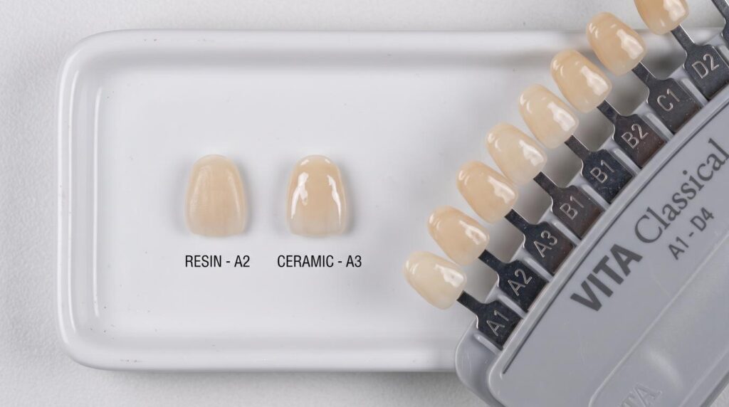 Side-by-side comparison of composite resin and porcelain veneer samples